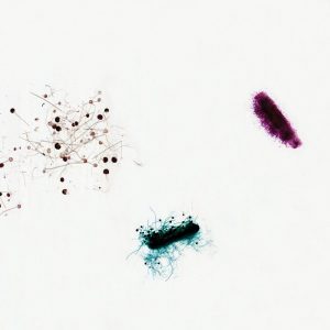 Mould Types Slide (CBS 077)