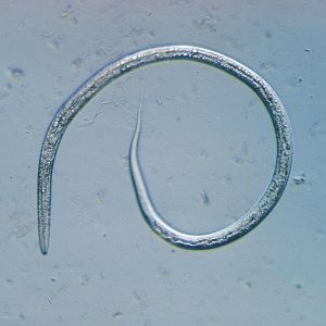 Vinegar Eels