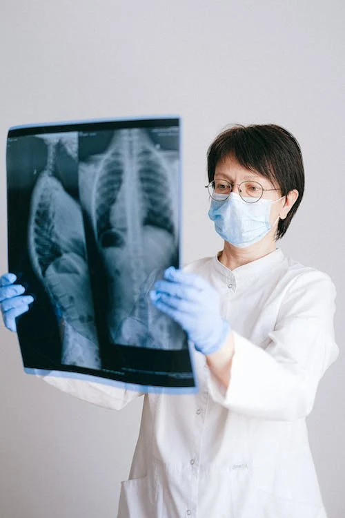 A doctor looking at a scan for lung cancer