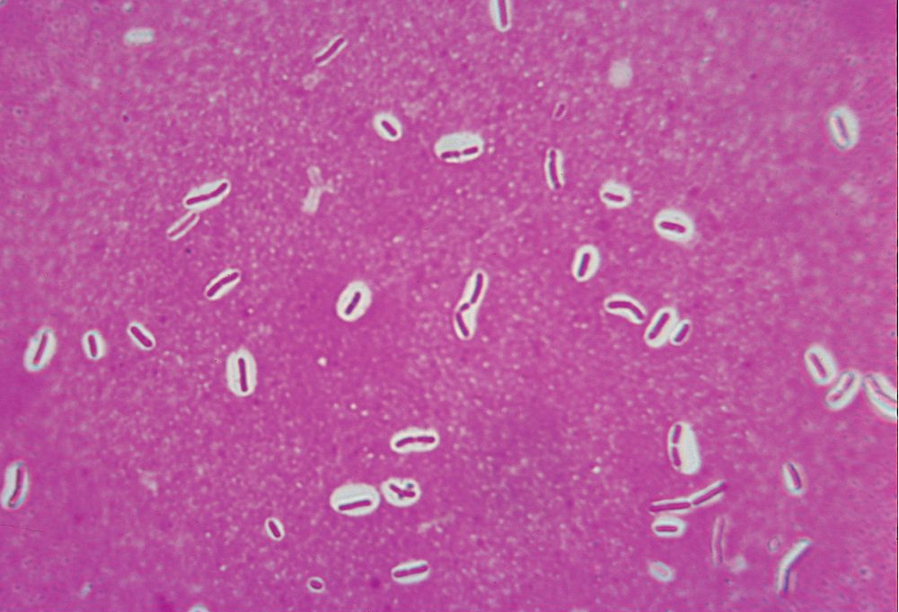 Bacterial Capsules, w.m, Slide. 