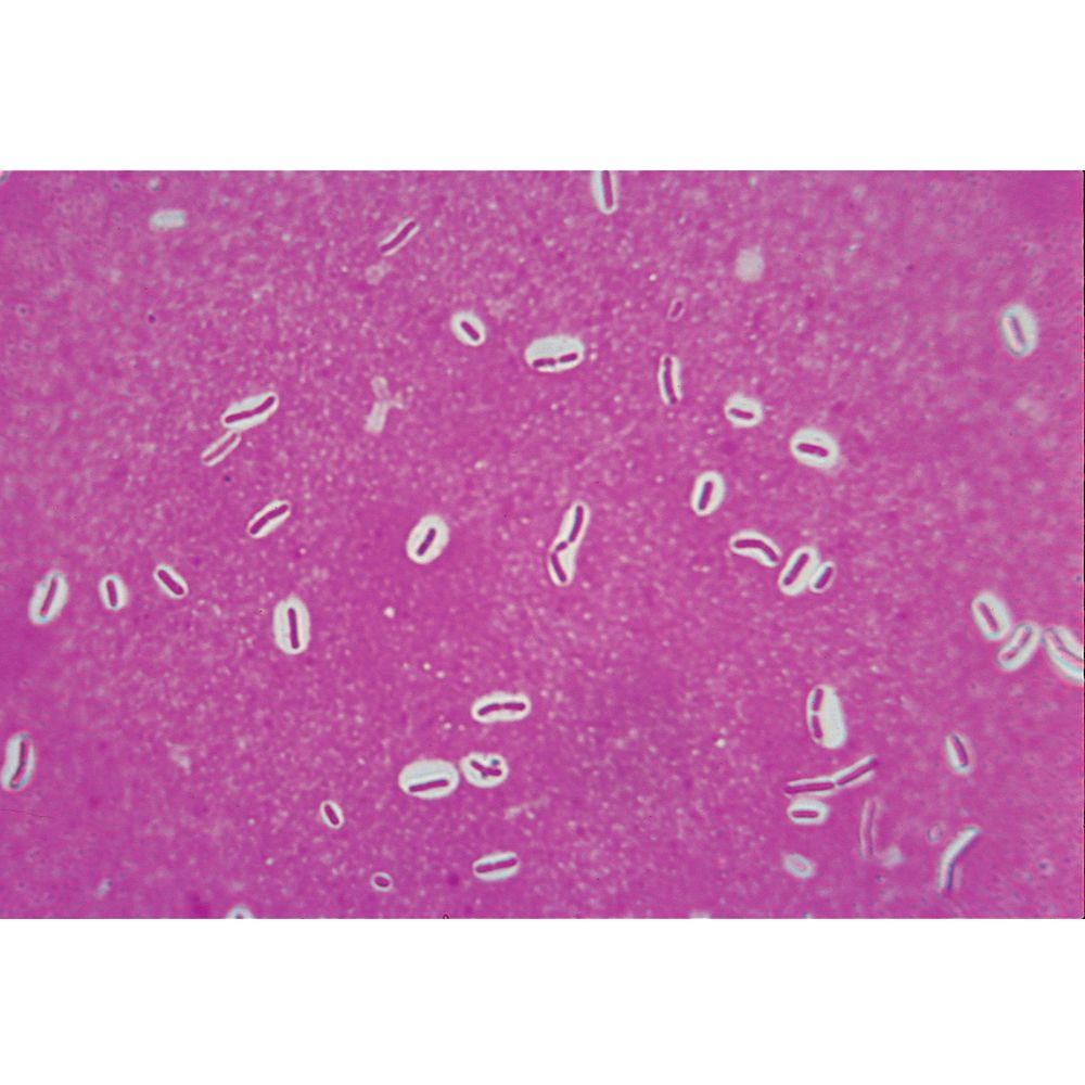 Bacterial Capsules, w.m, Slide