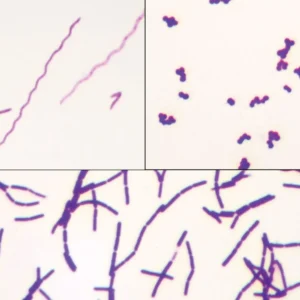 Bacterial Types Slide (CBS 056)