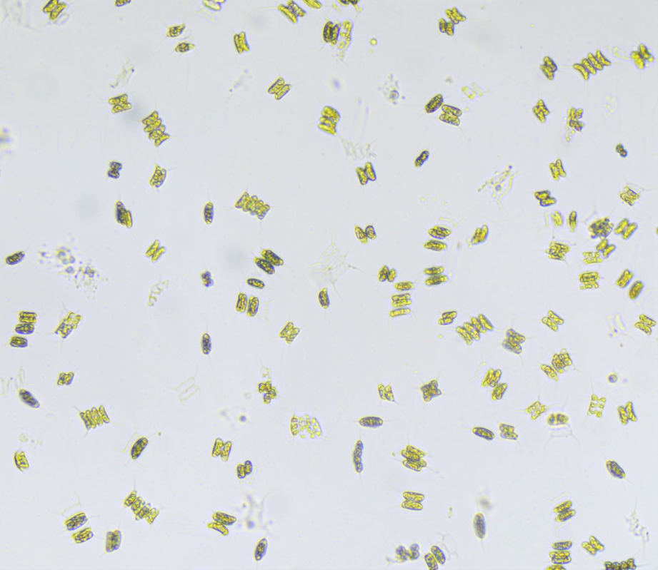 Scenedesmus quadricauda